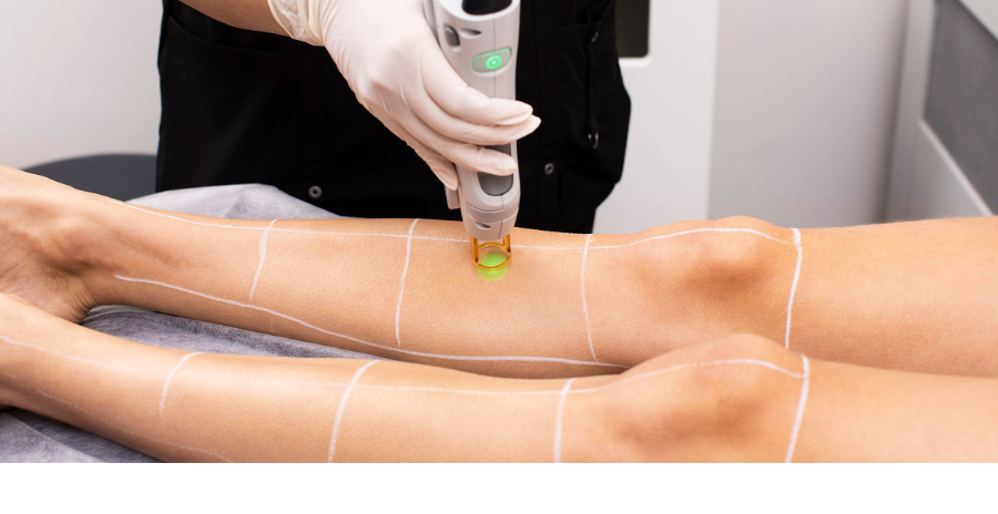 laser-clinics-why-should-you-do-a-full-body-laser-hair-removal